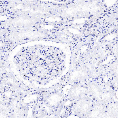 ARR3 Recombinant Rabbit mAb (S-3290-27)