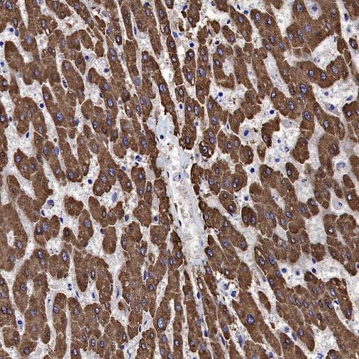ADK Rabbit Polyclonal Antibody
