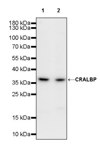 CRALBP Rabbit Polyclonal Antibody