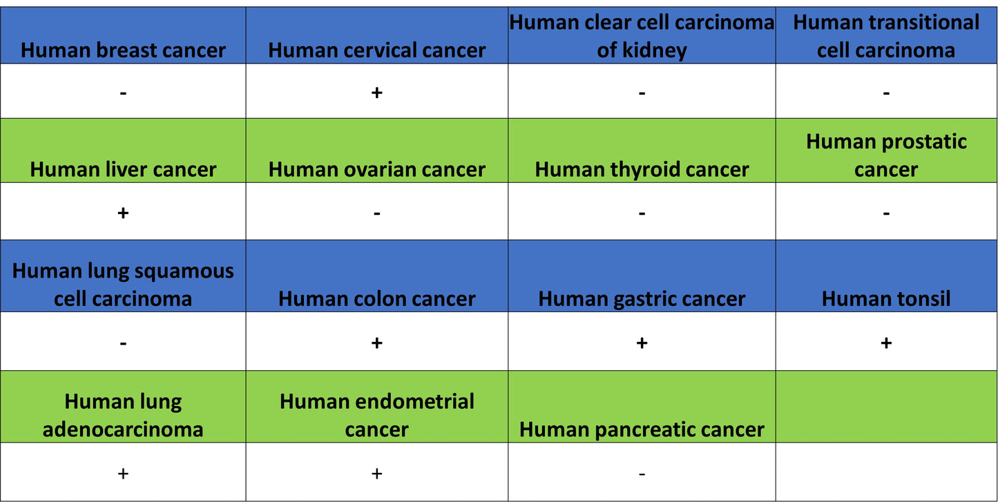 Phospho-Acetyl-CoA Carboxylase (Ser79) Recombinant Rabbit mAb (S-4302)