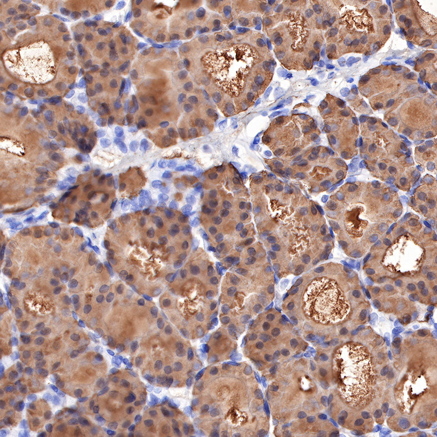 Thyroglobulin Recombinant Rabbit mAb (SDT-209-297)