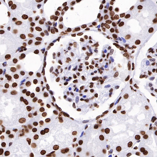 Histone H3 (mono methyl K36) Recombinant Rabbit mAb (S-R211)