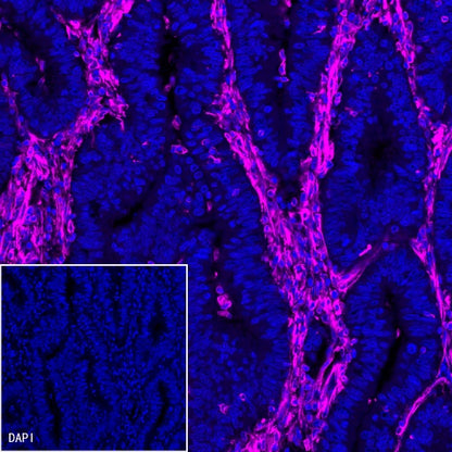 Vimentin Recombinant Rabbit mAb (Alexa Fluor® 647 Conjugate) (S-029-20)
