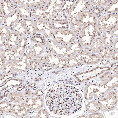 TFE3 Recombinant Rabbit mAb (SDT-760-34)