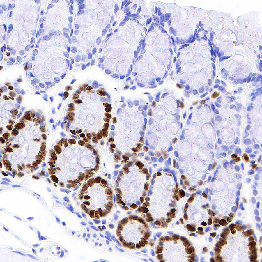 Ki67 Recombinant Rabbit mAb (S-4923-15)