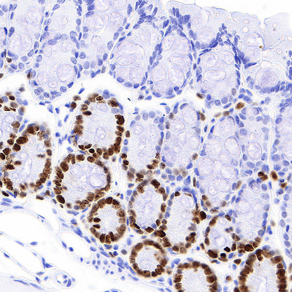 Ki67 Recombinant Rabbit mAb (S-4923-15)