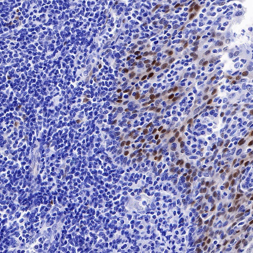 Cyclin D1 Recombinant Rabbit mAb (SDT-R423)