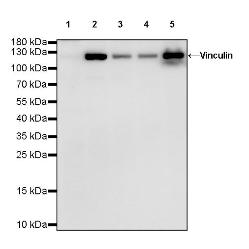 Vinculin Recombinant Rabbit mAb (S-1635-3)