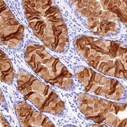 Reg4 Recombinant Rabbit mAb (SDT-1232-23)