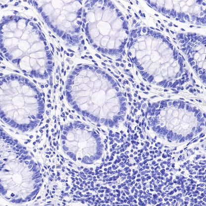 Synapsin-1 Recombinant Rabbit mAb (S-550-7)