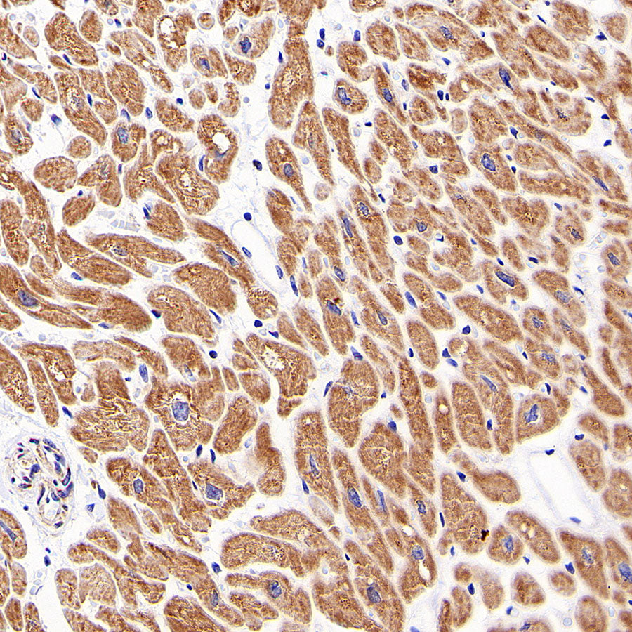 TOM20 Recombinant Rabbit mAb (S-M0015)