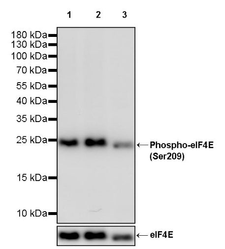 Phospho-eIF4E (Ser209) Recombinant Rabbit mAb (S-2652-195)