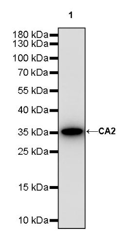 CA2 Rabbit Polyclonal Antibody