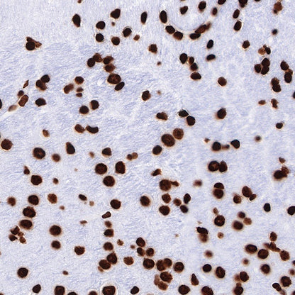 Histone H3 (tri methyl K27) Recombinant Rabbit mAb (SDT-431-118)