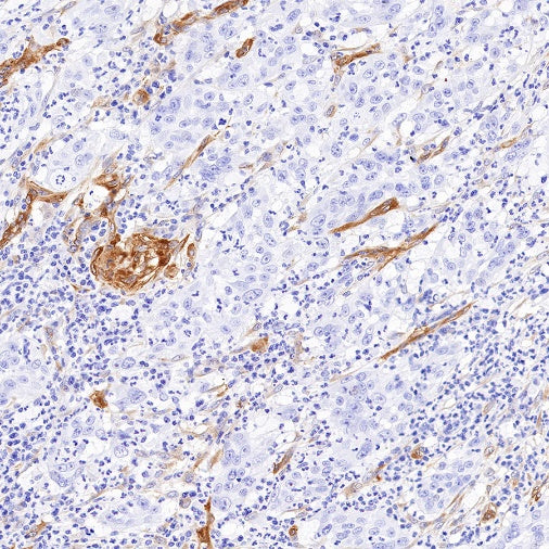 EHD2 Recombinant Rabbit mAb (S-1580-60)