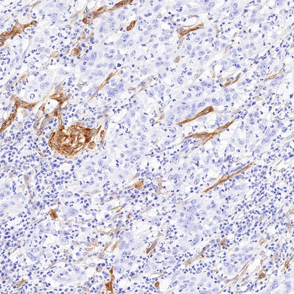 EHD2 Recombinant Rabbit mAb (S-1580-60)