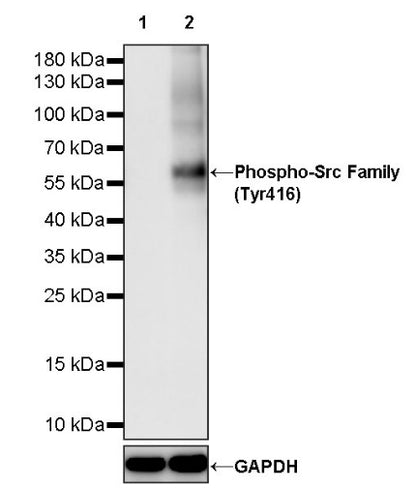 Phospho-Src Family (Tyr416) Recombinant Rabbit mAb (S-1556-29)
