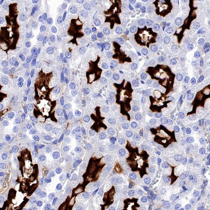 ACE2 Recombinant Rabbit mAb (S-1348-7)