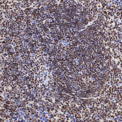 p27 Kip1 Recombinant Rabbit mAb (SDT-361-310)