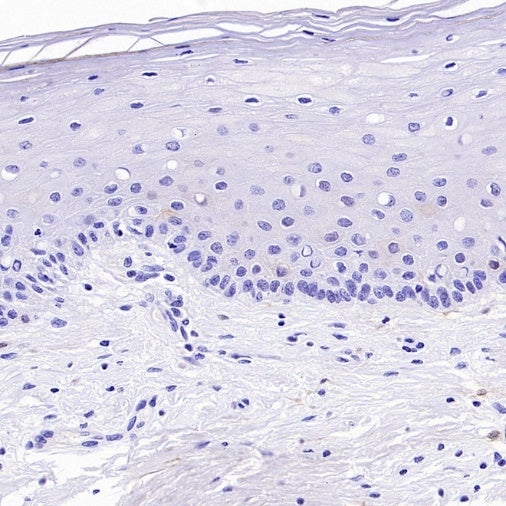 CDKN2A/p16 INK4A Recombinant Mouse mAb (SDT-4675)