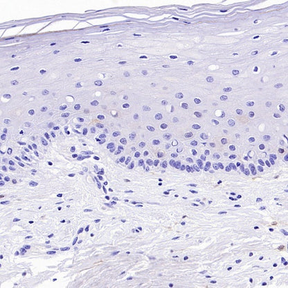 CDKN2A/p16 INK4A Recombinant Mouse mAb (SDT-4675)