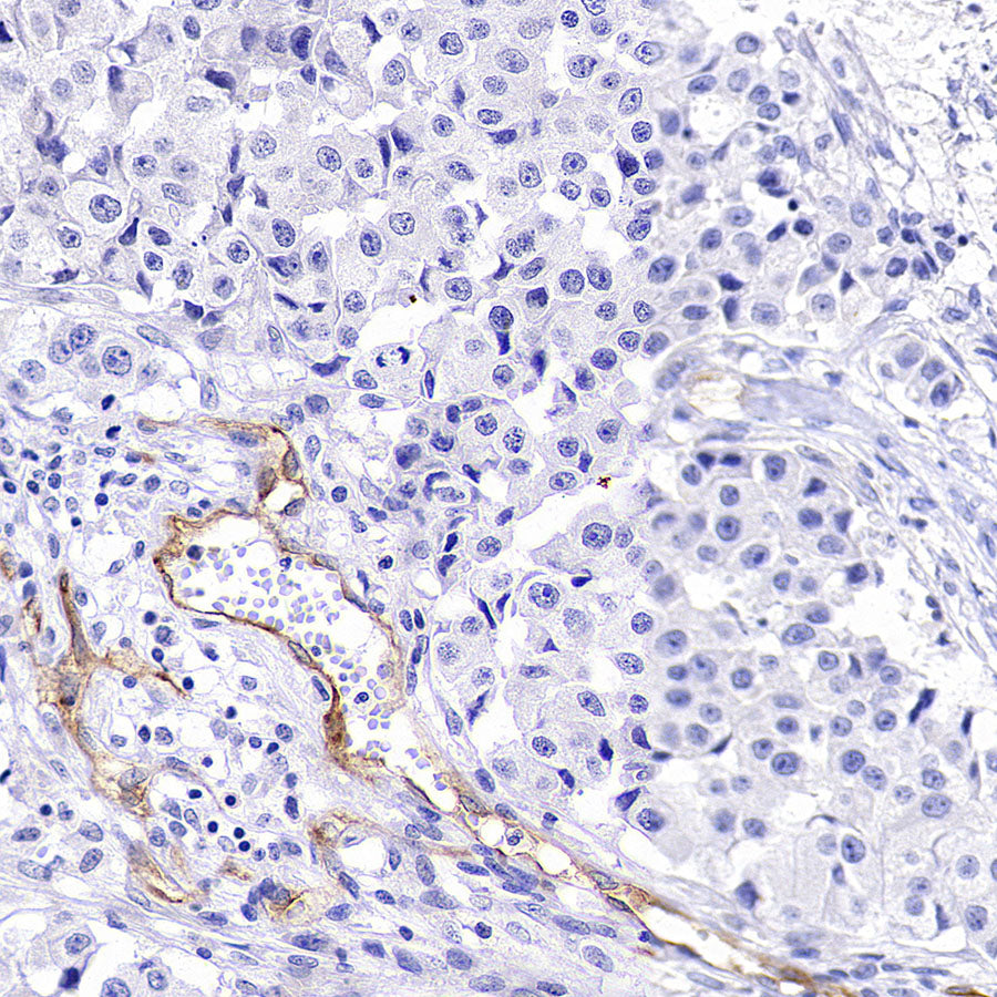 ICAM2/CD102 Rabbit Polyclonal Antibody
