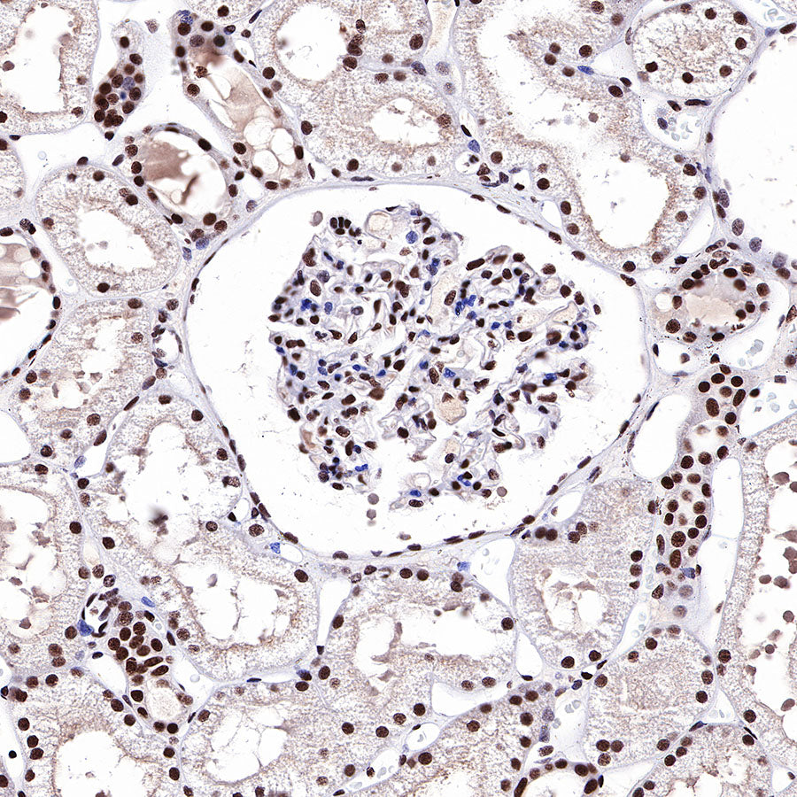 HDAC1 Recombinant Rabbit mAb (SDT-310-72)