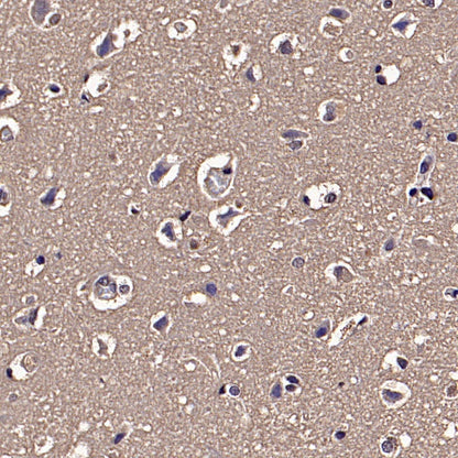 FACL4 Rabbit Polyclonal Antibody