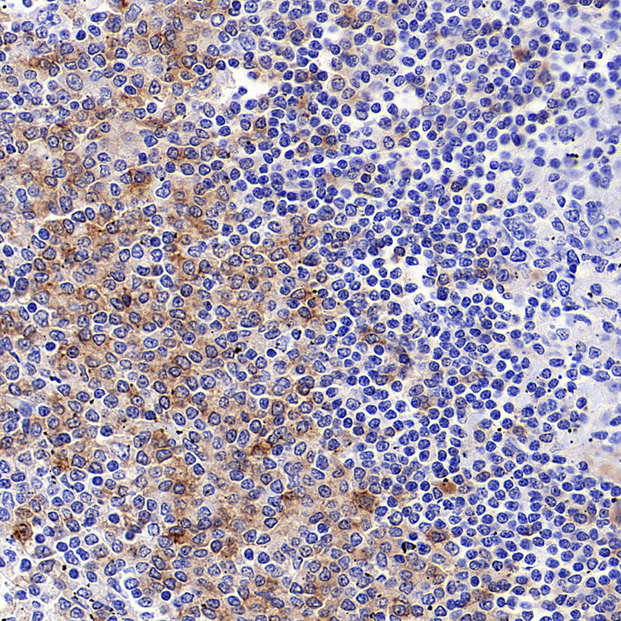 CD1c Recombinant Rabbit mAb (S-5242)