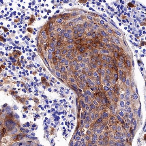 GPNMB Recombinant Rabbit mAb (S-R241)