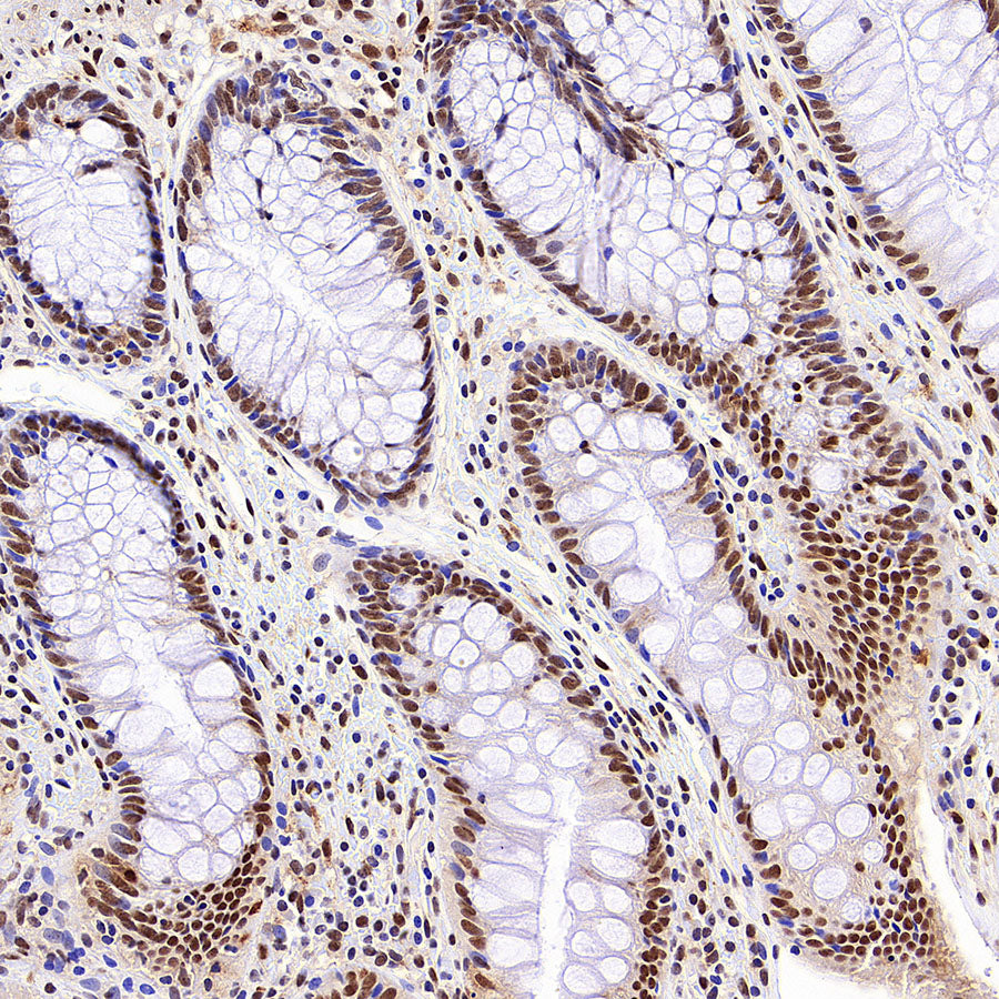Phospho-STAT1 (Ser727) Recombinant Rabbit mAb