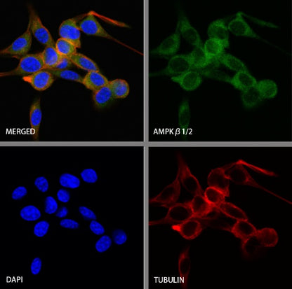 AMPKβ1/2 Recombinant Rabbit mAb (S-2728-26)
