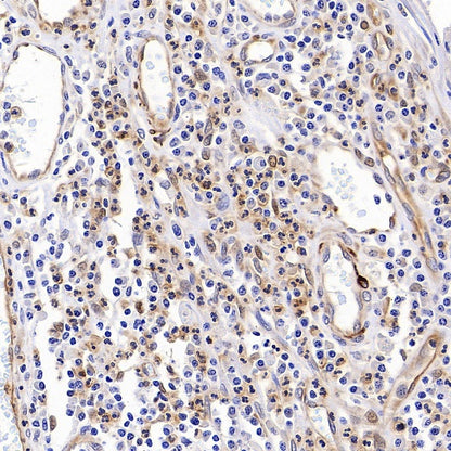 Phospho-Vimentin (Ser39) Rabbit Polyclonal Antibody
