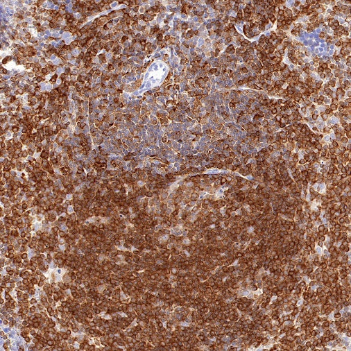 c-Rel Recombinant Rabbit mAb (S-1150-52)