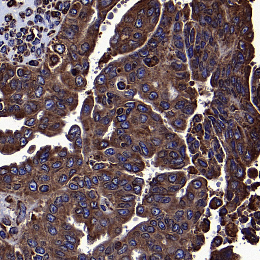 Calreticulin Recombinant Rabbit mAb (S-3920-39)