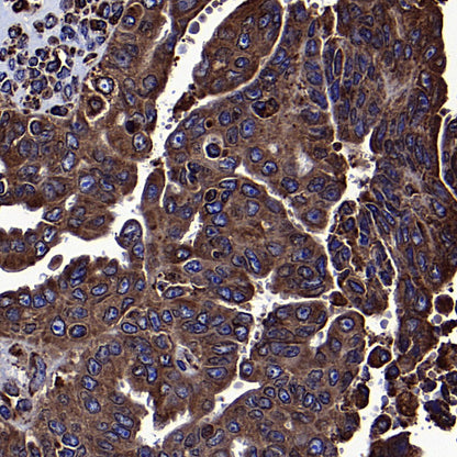 Calreticulin Recombinant Rabbit mAb (S-3920-39)