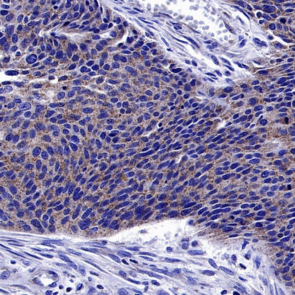 Pex14 Recombinant Rabbit mAb (S-2379-8)