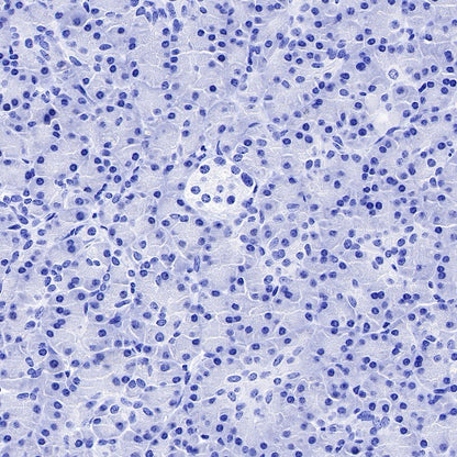 CCR7 Recombinant Rabbit mAb (S-999-29)