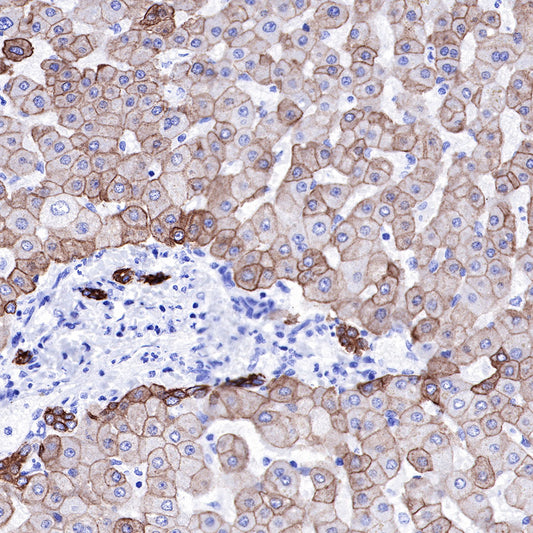 S-RMab® Keratin 18 Recombinant Rabbit mAb (SDT-012-7)