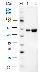 HDAC9 Protein, Human