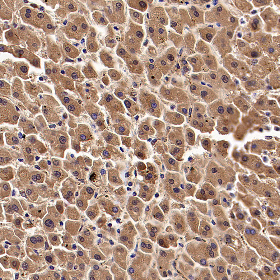 KCNMA1 Recombinant Rabbit mAb (S-2926-33)