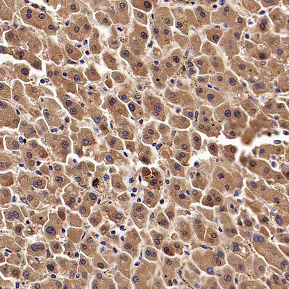 KCNMA1 Recombinant Rabbit mAb (S-2926-33)