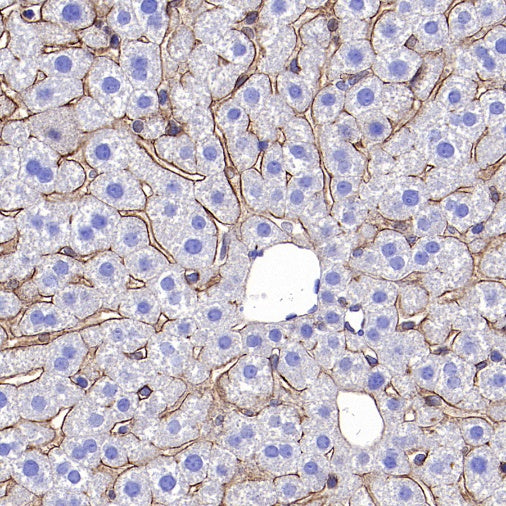 Integrin alpha 5 Recombinant Rabbit mAb (S-381-37)