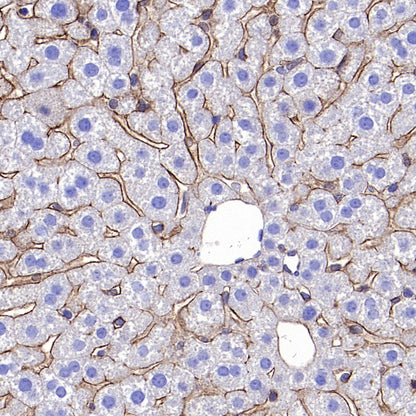 Integrin alpha 5 Recombinant Rabbit mAb (S-381-37)