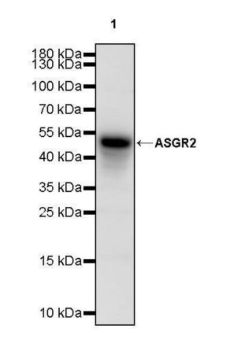 ASGR2 Recombinant Rabbit mAb (SDT-2059-47)