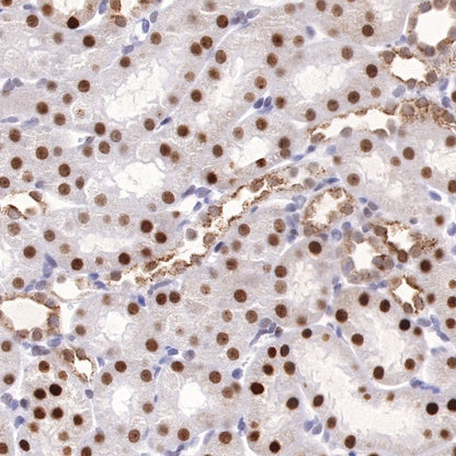 APE Recombinant Rabbit mAb (S-R349)