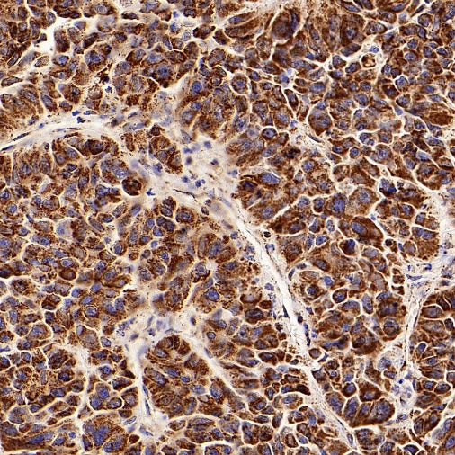 ATPB Rabbit Polyclonal Antibody