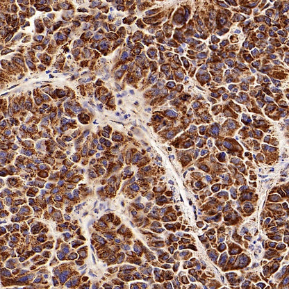 ATPB Rabbit Polyclonal Antibody