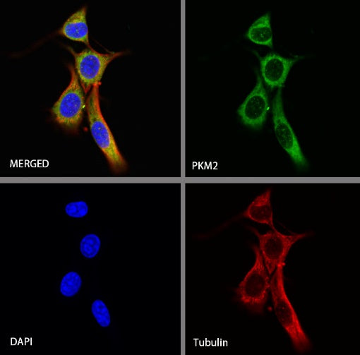 PKM2 Rabbit Polyclonal antibody