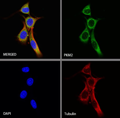 PKM2 Rabbit Polyclonal antibody